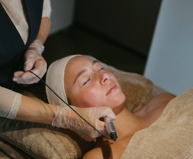 Microneedling